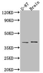NGF Antibody