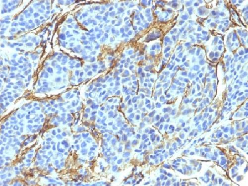 NGFR Antibody