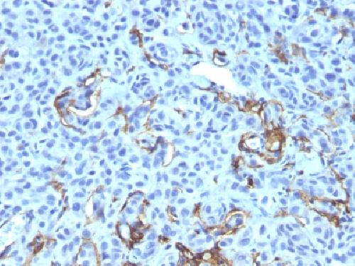 NGFR Antibody
