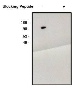 Rabbit anti Human NHE6/Sodium/hydrogen exchanger 6 Antibody