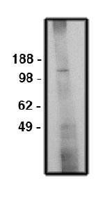 Rabbit anti Human NHE6/Sodium/hydrogen exchanger 6 Antibody