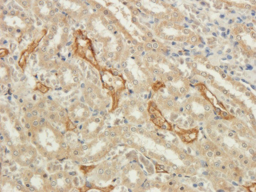 NINJ1 Rabbit Polyclonal Antibody