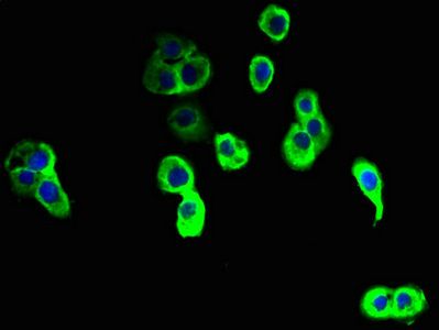 NINJ2 Antibody
