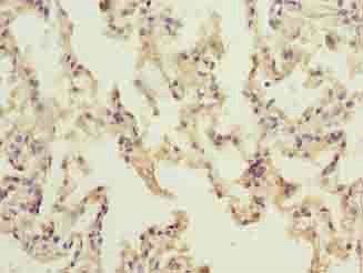 NINJ2 Antibody