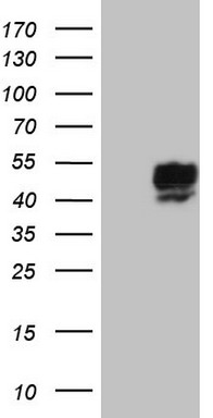 NIPP1 Antibody