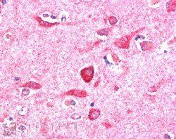 NIR1/PITPNM3 Antibody
