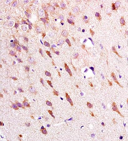Neurokinin A Receptor Rabbit Polyclonal Antibody