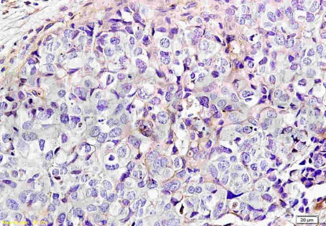 NCR2 Rabbit Polyclonal Antibody