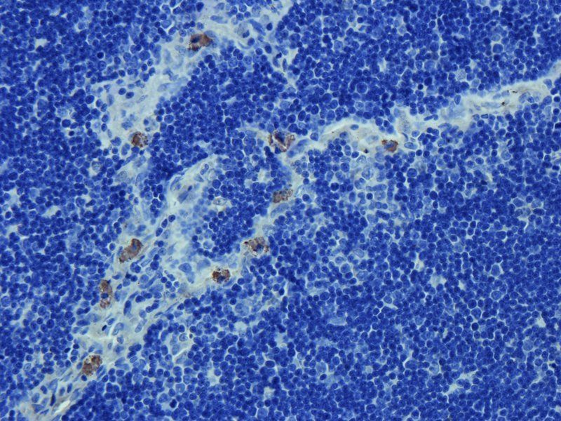 NKp46 antibody