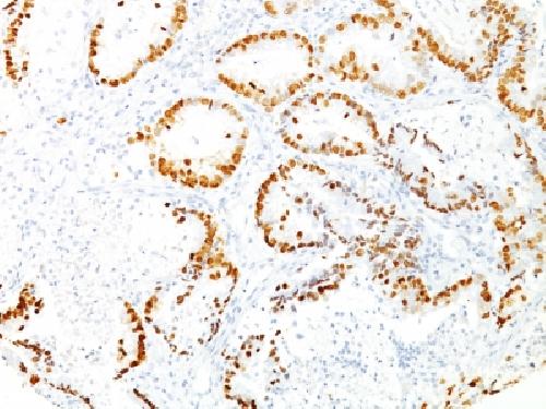 NKX2-1 Antibody