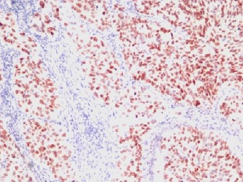 NKX2-1 Antibody