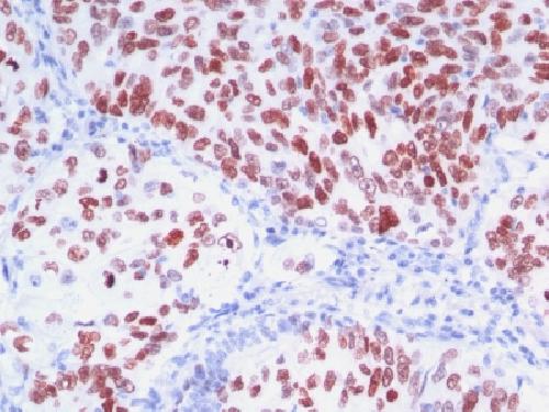 NKX2-1 Antibody