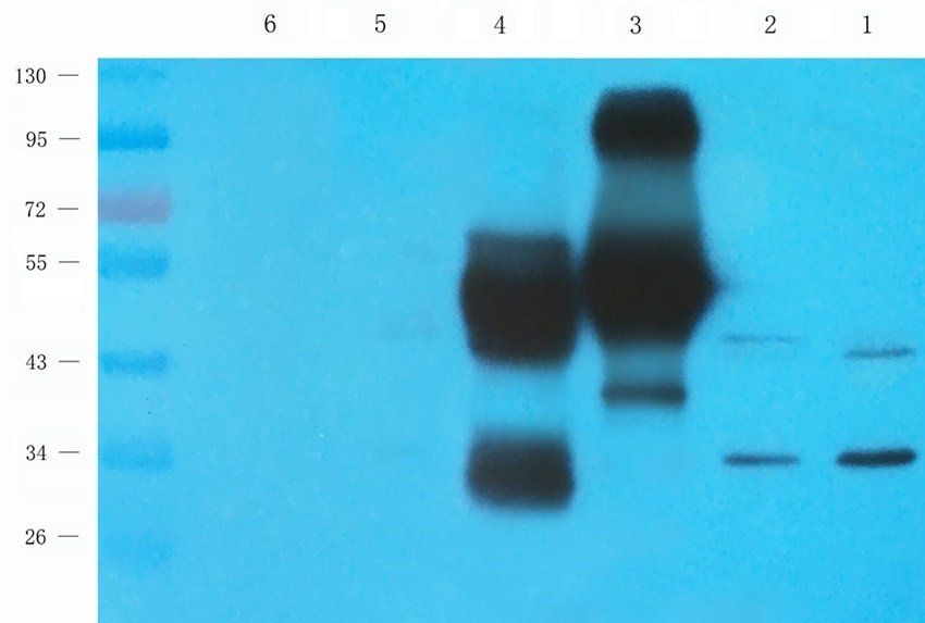 NKX2-5 Rabbit Polyclonal Antibody