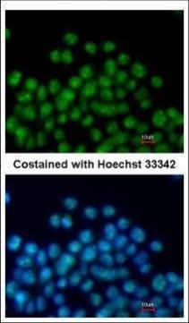 Nkx2.5 Rabbit Polyclonal Antibody