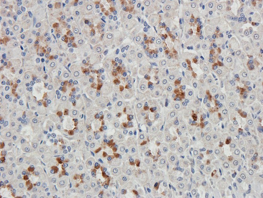 NKX6-1 Rabbit Polyclonal Antibody