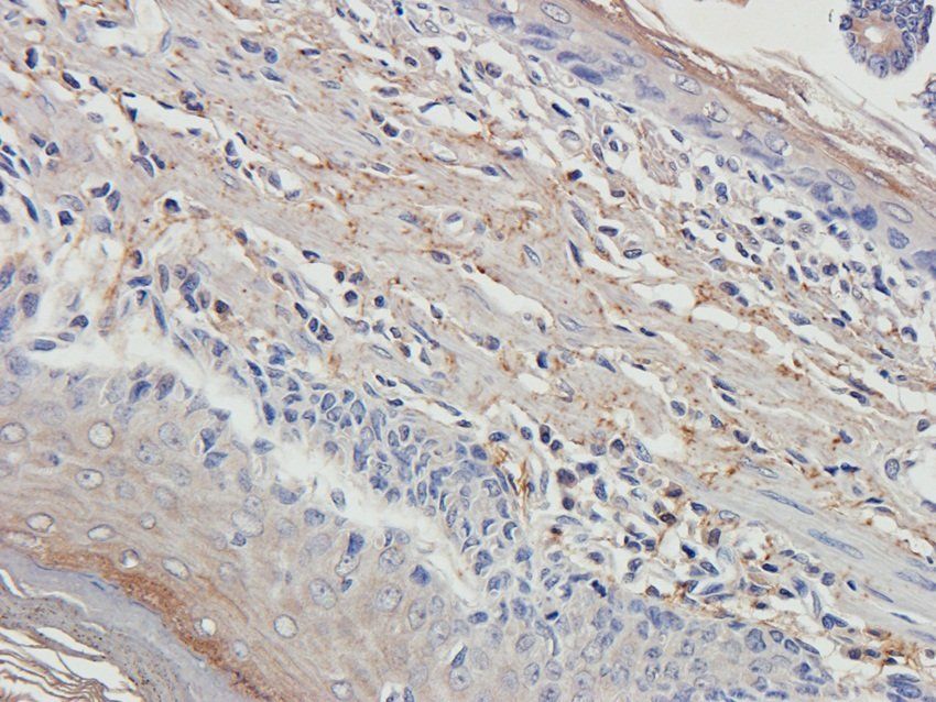 NKX6-1 Rabbit Polyclonal Antibody