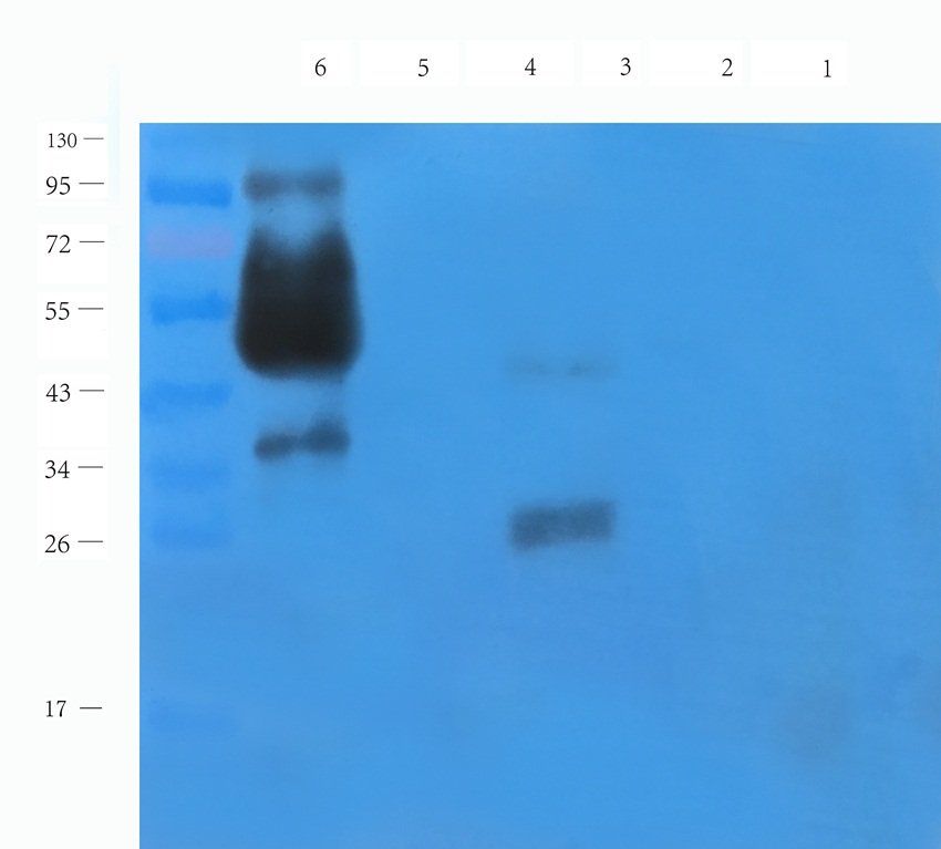 NKX6-1 Rabbit Polyclonal Antibody
