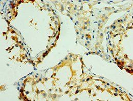 NLGN4Y Antibody