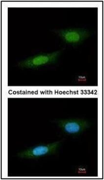 NLK Rabbit Polyclonal Antibody