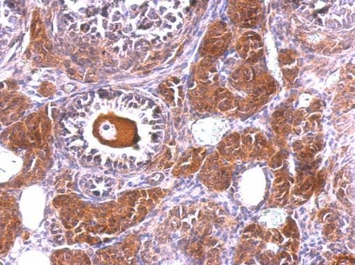 NLK Rabbit Polyclonal Antibody