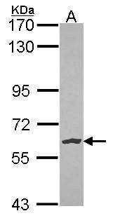 NLK Rabbit Polyclonal Antibody