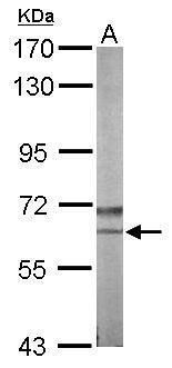 NLK Rabbit Polyclonal Antibody