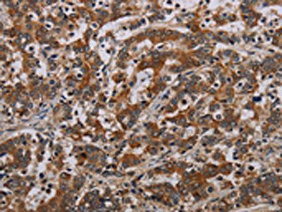 NLRP9 Antibody