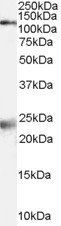 NMDA receptor 1/GRIN1 Antibody