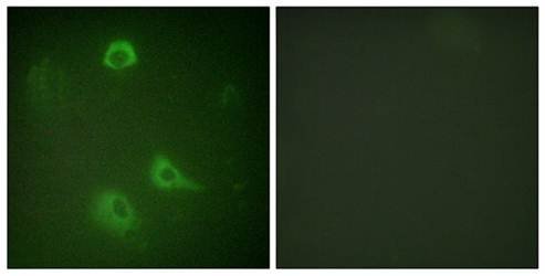 NMDAR1 (Phospho-Ser890) Antibody