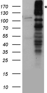 NMDAR2A Antibody