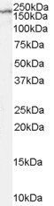 NMDAR2B/GRIN2B Antibody