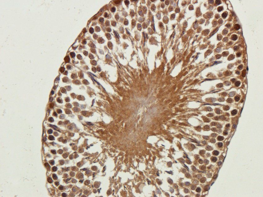 NMDE2 Rabbit Polyclonal Antibody