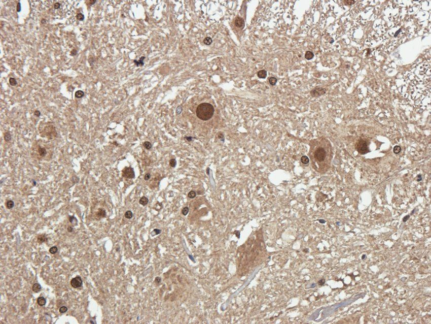 NMDE2 Rabbit Polyclonal Antibody