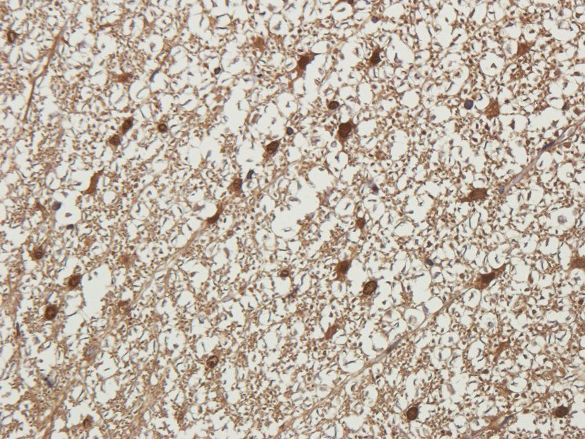 NMDE2 Rabbit Polyclonal Antibody