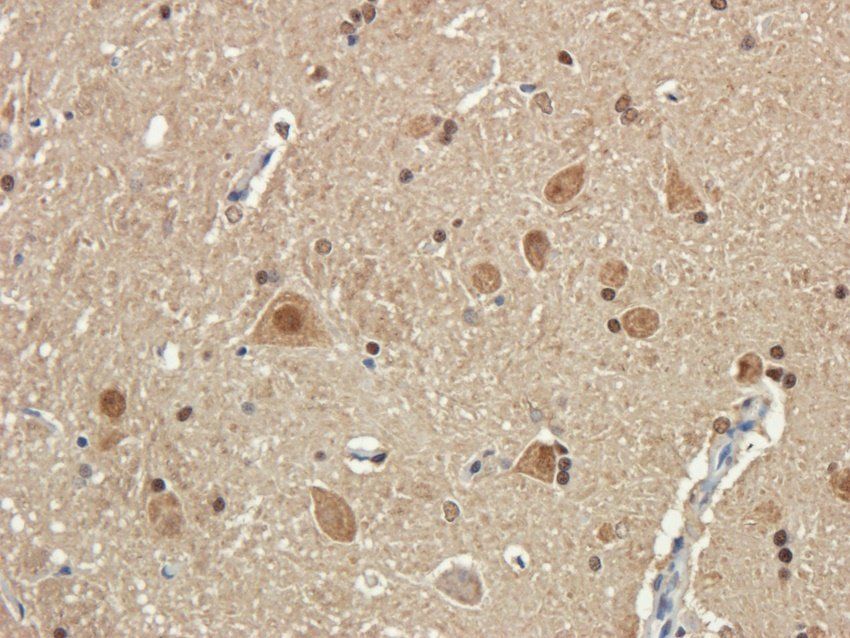 NMDE2 Rabbit Polyclonal Antibody