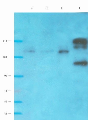 NMDE2 Rabbit Polyclonal Antibody