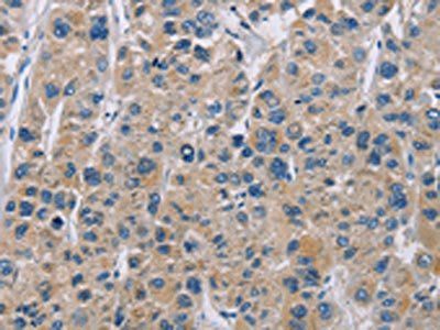 NME5 Antibody