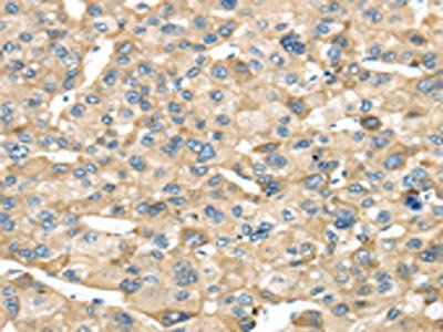 NME8 Antibody