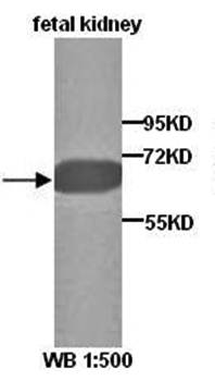 N-Myc Rabbit Polyclonal Antibody