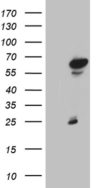 NOB1 Antibody