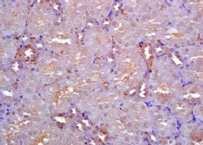 Nodal Rabbit Polyclonal Antibody