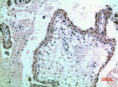 NOP56 Antibody