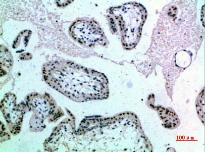 NOP56 Antibody