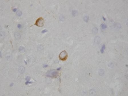 nNOS/NOS1 Rabbit Polyclonal Antibody