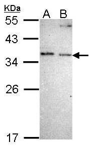 COMMD7 Rabbit Polyclonal Antibody