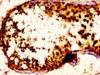 NOVA1 Antibody