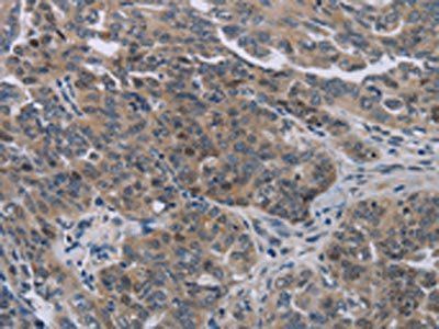 NOX1 Antibody