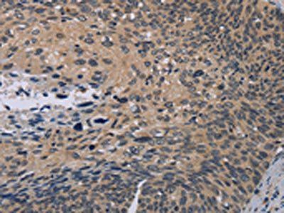 NOX1 Antibody