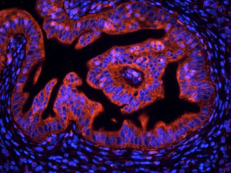 NOX1 Rabbit Polyclonal Antibody