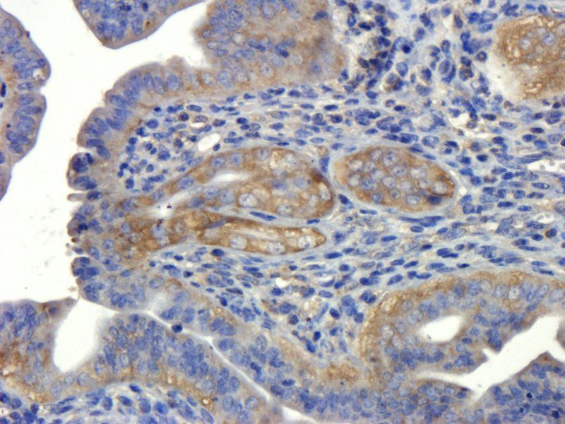 NOX1 Rabbit Polyclonal Antibody